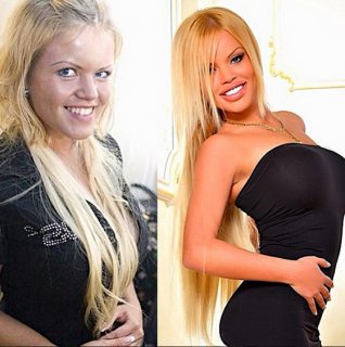 25-летняя Олеся Малибу до пластики (слева) и после